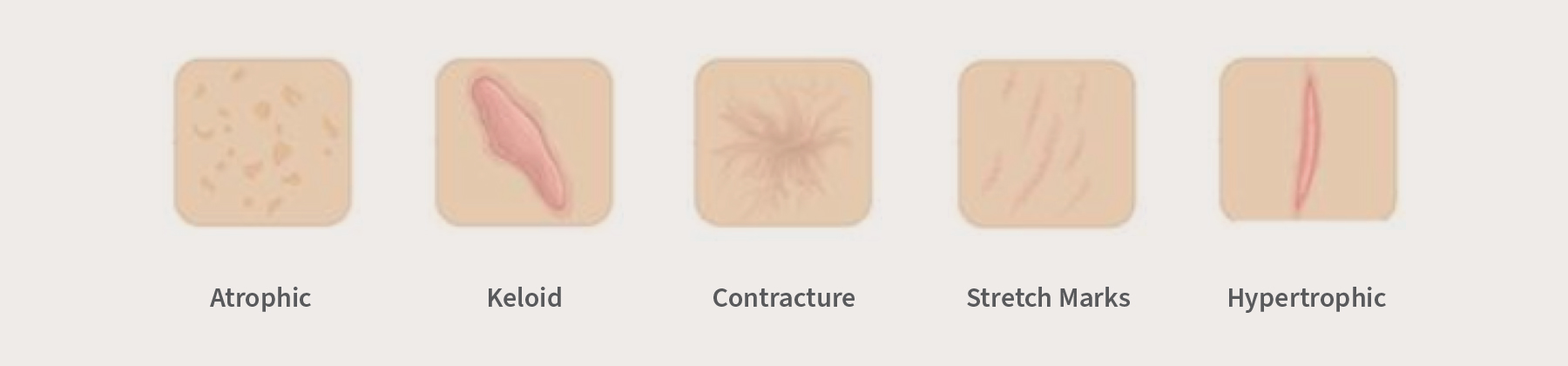 Tr Pro TR Pro+ | Post Procedure Aesthetic Gel