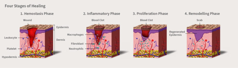 Tr Pro TR Pro+ | Post Procedure Aesthetic Gel